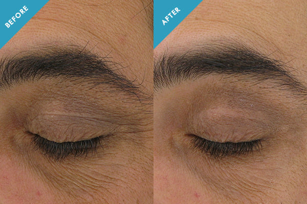 SKINCEUTICALS AOX+ EYE GEL 15ML - Skinty Dermocosmetic Shop